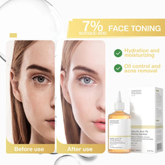 Transform Your Skin with Glycolic Acid 7% Toning Serum